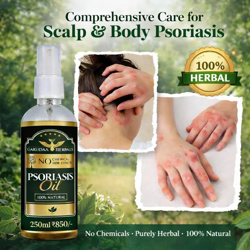 Green Veda HERBALS Psoriasis -Clearing Oil