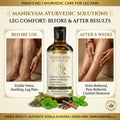 VARICOSE VEINS PAIN RELIEF OIL - Ayurveda Oil Relief 60 Days Challenge